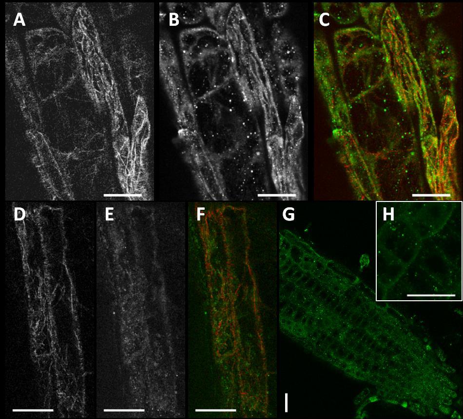 6.2.4 Imunofluorescence - kolokalizace Dále bylo provedeno dvojité značení vzorků, pomocí protilátek proti aktinu a proti podjednotkám ARP2/3 komplexu (ARP2, ARP3, ARPC2).