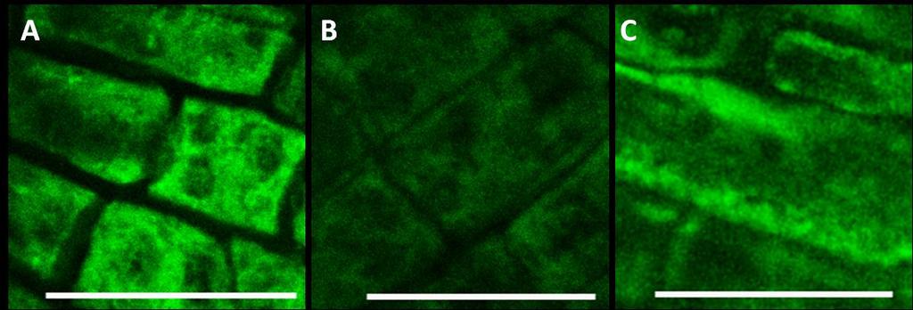 24 Pokožka elongační zóny kořene několikadenních rostlin wt Arabidopsis, stabilně transformovaných konstruktem GFP-NtArpC2, indukovaných 2µM estradiolem a fixovaných procedurou na značení