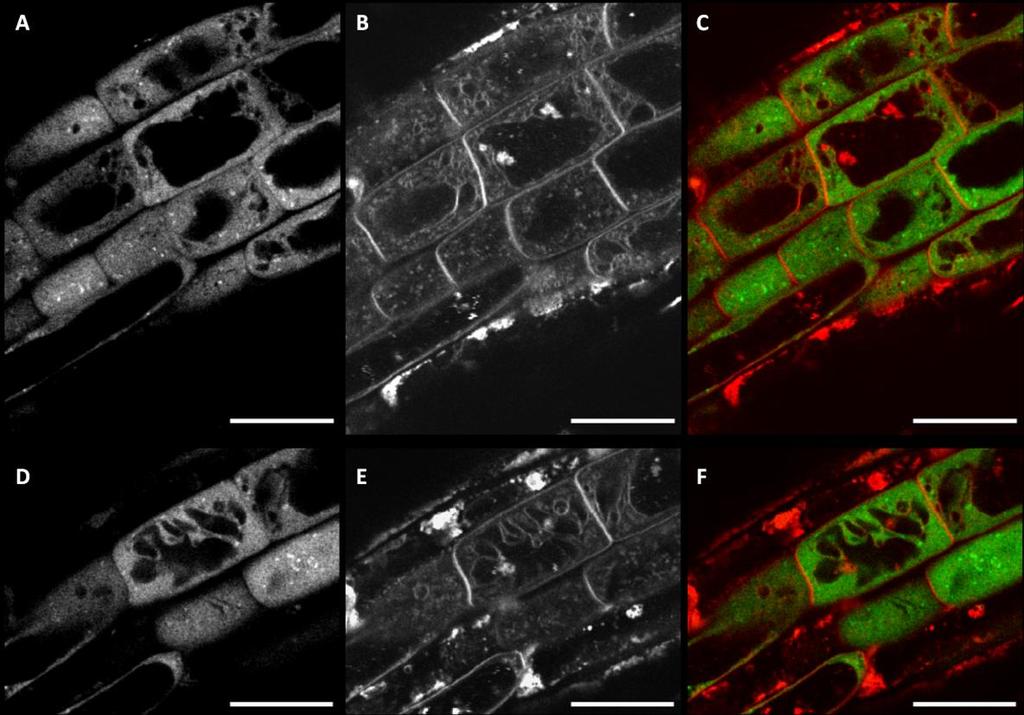 Obr. 26 Pokožka elongační zóny kořene několikadenních rostlin wt Arabidopsis, stabilně transformovaných konstruktem GFP-NtArpC2 (zelený kanál) a indukovaných 2µM estradiolem.