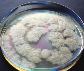 1 Kolonie acillus cereus CCM 2010 T na plate-count agaru