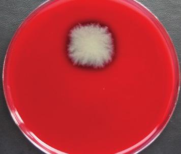 238 rewing microbiology bacteria of the genera