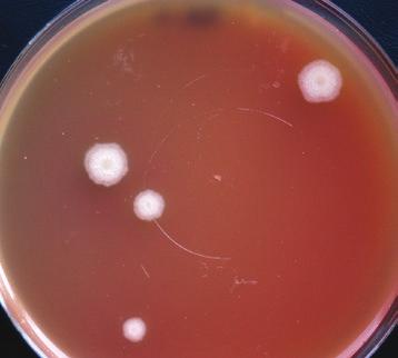 rewing microbiology bacteria of the genera acillus, revibacillus and Paenibacillus and cultivation methods 239 wrinkled with a glossy surface (after sporulation).. subtilis subsp.