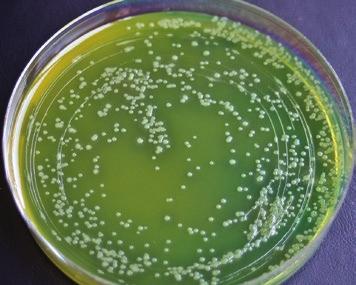 240 rewing microbiology bacteria of the genera acillus, revibacillus and Paenibacillus and cultivation methods Fig.