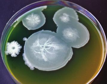 6 Kolonie bakterií na PEM agaru po 48 hodinách inkubace při 28 C, revibacillus brevis CCM 2050 T ;, acillus subtilis subsp. subtilis CCM 2216 T. Fig.