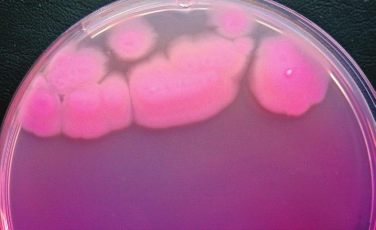 color of the colonies confirmed that. cereus does not utilize lactose, which is in agreement with Logan and De Vos (2015)).