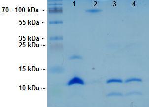 5.5. Koexprese PI4KIIαT4 a VAMP 3 V naší laboratoři byl připraven expresní plasmid obsahující nukleotidovou sekvenci proteinu VAMP 3 (jejíž součástí je His kotva) a zároveň proteinu PI4KIIαT4 (bez