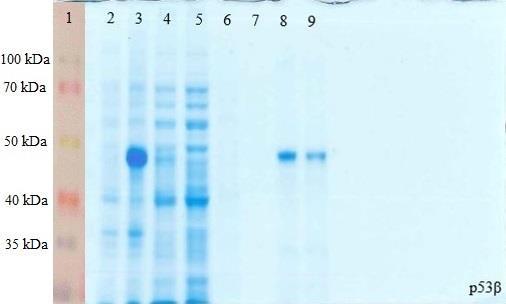 Obrázek 21: Izoforma p53β polyakrylamidový gel s dodecylsíranem sodným, start č. 1: Proteinový žebříček 10 260 kda; start č. 2 č. 7: Kontrolní vzorky odebírané během produkce a purifikace; start č.