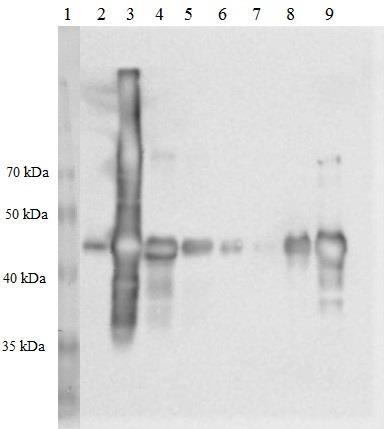 Obrázek 24: Izoforma Δ40p53β membrána po westernovém přenosu a aplikaci protilátek, start č. 1: Proteinový žebříček 10 260 kda; start č. 2 č.
