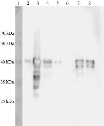 Obrázek 25: Izoforma Δ40p53γ membrána po westernovém přenosu a aplikaci protilátek, start č.