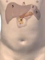 Diabetes mellitus Klasifikace DM Patogeze T1DM a T2DM Komplikace diabetu Definice DM DM je skupina metabolických omocnění charakterizovaných hyperglykemií v důsledku dostatečného účinku inzulinu