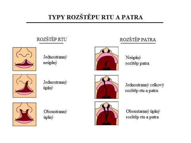 o ojedinělé případy a jejich sběr není standardizován.