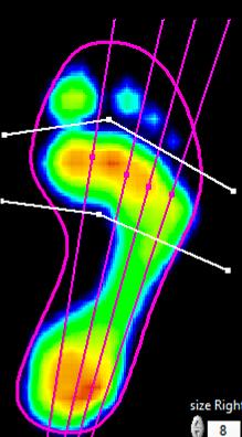 Regiony byly v programu footscan7 rozděleny pomocí podélných a příčných korigovatelných přímek tak, aby kopírovaly následující model (obr.