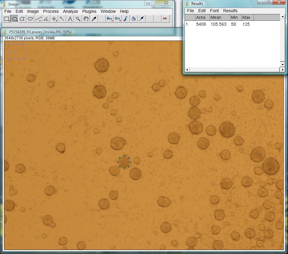 3.3. Analýza obrazu s ImageJ ImageJ je freeware program vyvinutý v National Institutes of Health pro analýzu obrazu. V programu lze měřit jak manuálně, tak automatizovaně.
