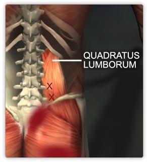 1. m. quadratus lumborum,,šprýmař bolesti dolní části zad Origo: crista iliaca a vazy mezi ní a páteří, procc. costales bederních obratlů Ins.: část 12.