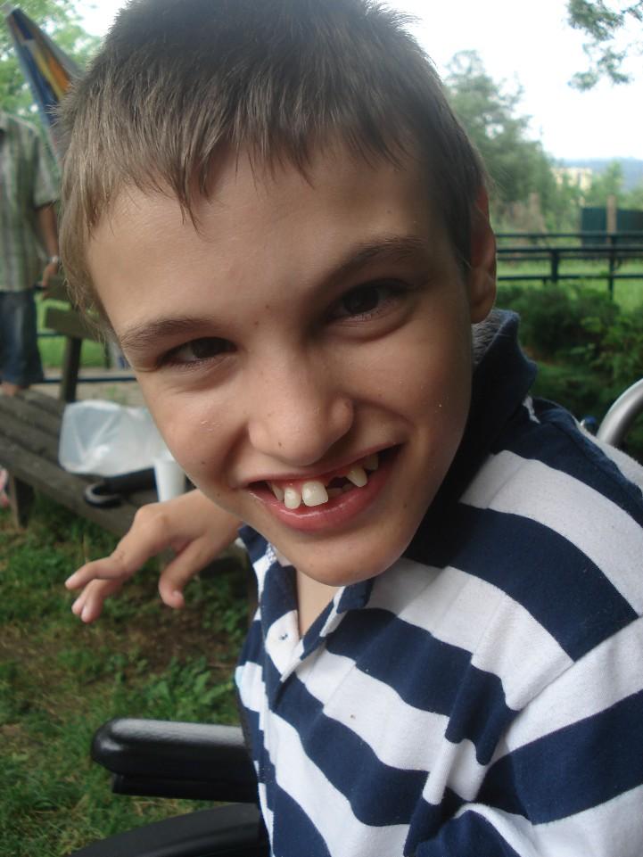 často jsou přítomny neurologické a jiné tělesné nedostatky postihující hybnost, epilepsie, poškození zraku a sluchu diagnóza zahrnuje