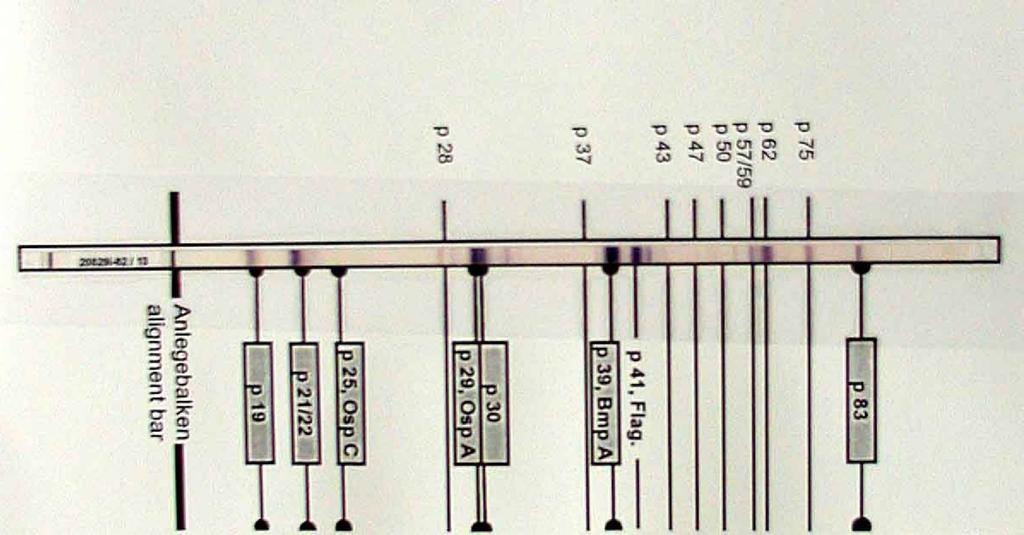 Western blot vzhled