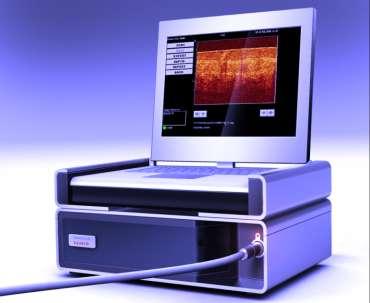 2. 2. 3. LUMA cervical imaging system Tento systém používá vlastností spektroskopie v tkáních in vivo.