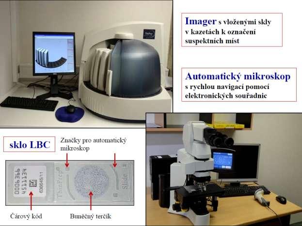připojena kamera, ta je spojena s výkonným počítačem vybaveným programem pro záznam a analýzu obrazů snímaných kamerou při skenování preparátu (obrázek 35).