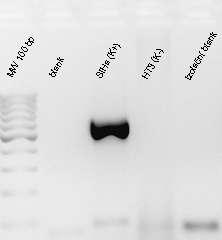 Obrázek 40: PCR produkty detekce HPV 16 a 18.