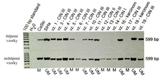Obrázek 51: Výsledky analýzy metylačního štěpení. Použita endonukleáza McrBC u HPV16 pozitivních klinických vzorků.