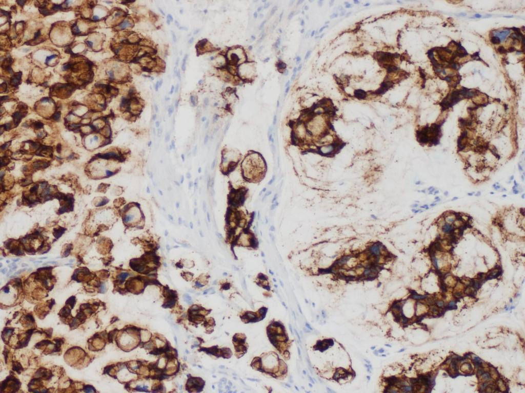 peritonea