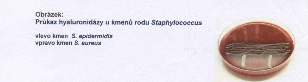 test na hyaluronidázu princip: pomocí testu dekapsulace mukozního kmene Streptococcus