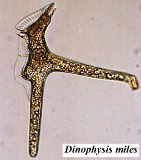 DSP Diarrhetic