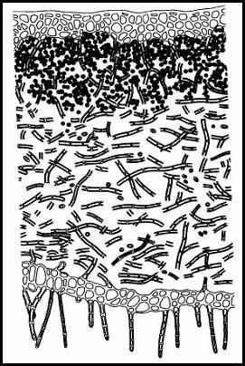 aphthosa svrchní korová vrstva (epidermis) vrstva fotobionta (řasová,