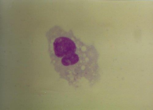 Obrázek 4: Monocyt se známkami