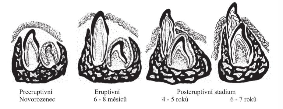 1.2.2 Fáze erupce zubů Dynamicky proces prořezáváni stály ch zubů popisujeme podle jednotlivy ch jeho fázi a konkrétních stadií. Malínský (Malínský et al.