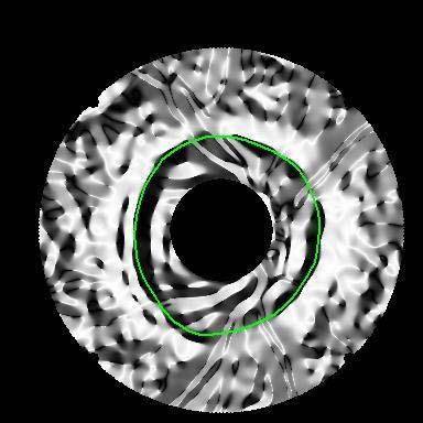 for i = 1 sloupce for j = 1..řádky Theta(i,j) = výpočet směru z px,py složky, arctan(py/px); Theta_b(i,j) = vypočet ideálního směru; EXT1(i,j) = abs ( Theta(i,j) Theta_b(i,j) ) - pi; end end 13.