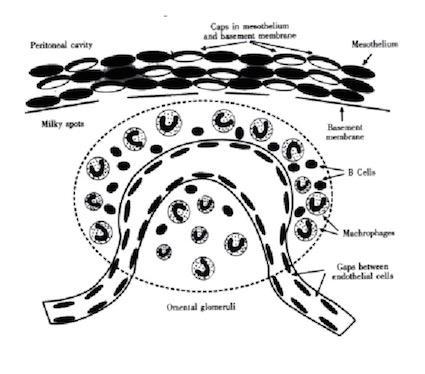 Mléčné skvrny (Milky spots)* opaleskující mléčné makuly (0,5 4 mm) vlásečnicový pseudoglomerulus složený z makrofágů a lymfocytů (monocytů, plazmocytů, mastocytů a