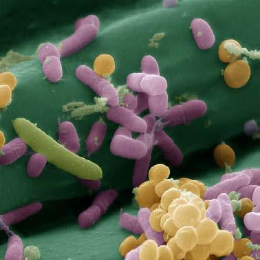Bakterie a houby přichycené k vláknům Cutimed Sorbact