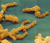 Proč potřebují mikrobi hydrofóbní interakci na povrchu buněk?