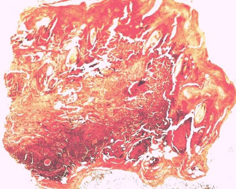 11.4 Mikroskopické hodnocení Z důvodu značné traumatizace koní při odběru vzorků tkáně jsme pro histologické hodnocení použili psy.