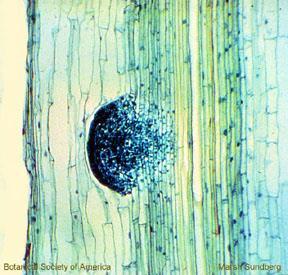 develops from parenchyma