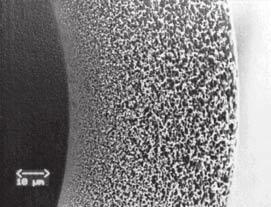 8 Odlišná struktura různých syntetických materiálů dialyzačních membrán a relativně