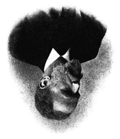 Kapitoly z historie Bernhard Naunyn 2. září 1839 26. července 1925 Významný německý lékař-internista Bernhard Naunyn se zapsal do dějin léčení cukrovky nejvíce tím, že na sklonku 19.