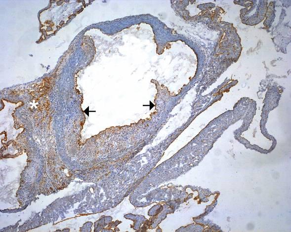 5.2.2. Imunohistochemické barvení endoglinu v oblasti aortálního sinu Exprese endoglinu byla pozorována hlavně v cévním endotelu, a to jak v oblasti aorty, tak menších cév a kapilár v okolním myokardu.