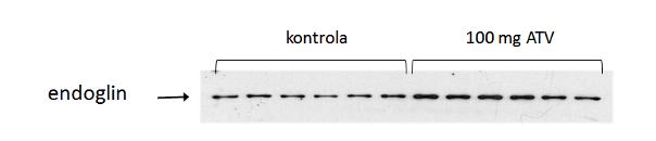 5.3.2. Exprese endoglinu Western blot analýza exprese endoglinu měla za cíl prokázat celkovou expresi endoglinu ve stěně hrudní a břišní aorty.