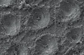 účinná osteointegrace 12,13.