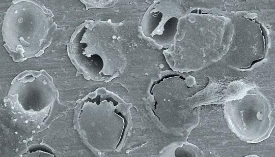 % BIC Větší kontaktní osteogeneze Díky vysoké adhezi fibrinu Synthegra přitahuje větší počet osteogenních buněk a umožní jim usadit se stabilním způsobem na povrchu implantátu.