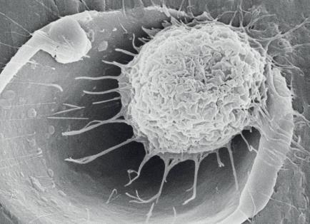 menší bakteriální adheze nižší riziko periimplantitidy 2 větší adheze fibrinu