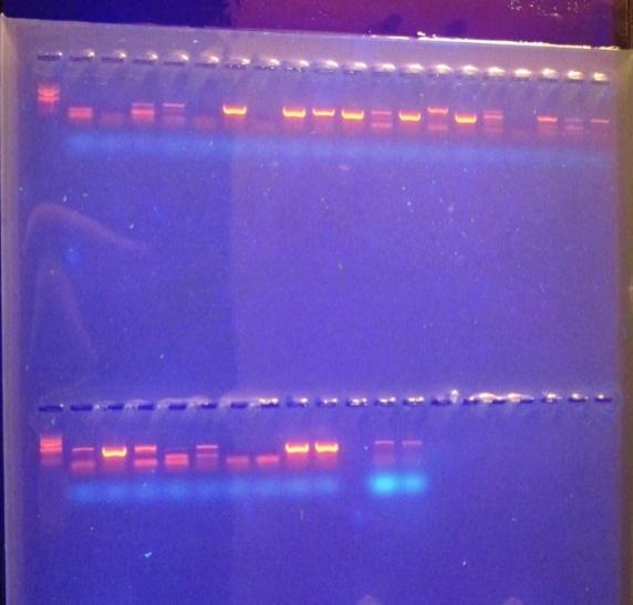 Detekce fusarií PCR metodou Byl pouţit DNeasy Plant Mini Kit - QIAGEN - primer např.