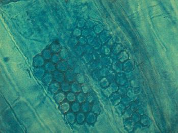 obr. 1: Cystosory houby Polymyxa betae. obr. 3: Vadnutí rostlin napadených rizománií. obr. 2: Nespecifické chlorotické žloutnutí rostlin cukrovky napadených rizománií.