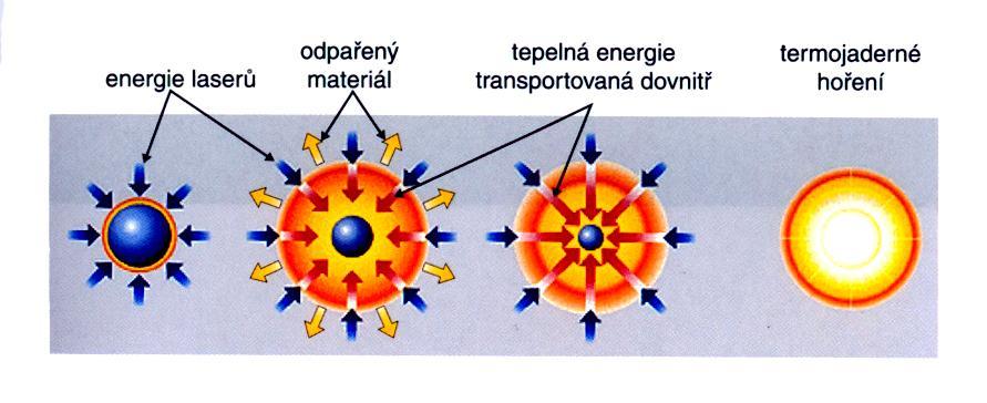 magnetické nádoby plazma je udržováno silným magnetickým polem (1T), tokamak inerciální fúze superrychlý ohřev plazmatu drobné terče z vhodných