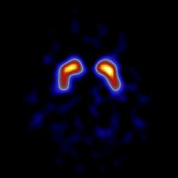 transporter ligands Post-synaptic