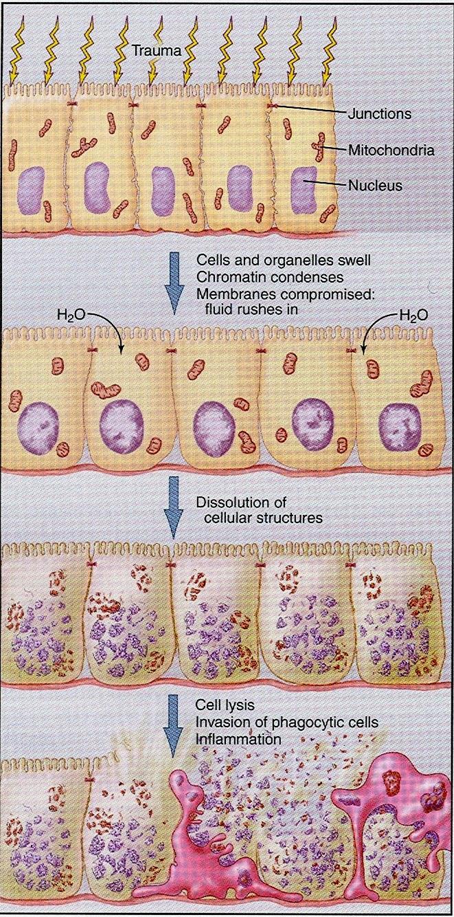 NEKRÓZA Buňka a organely bobtnají, chromatin kondenzuje, membrána poškozena, voda vniká do buňky