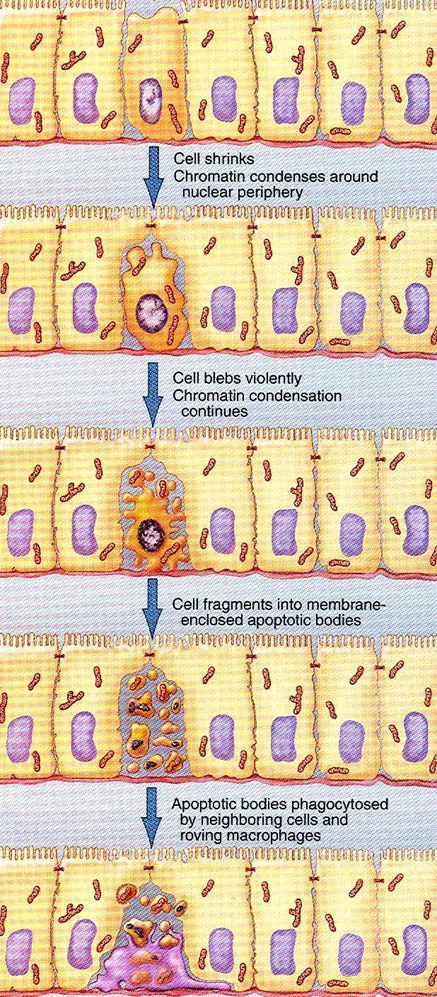 APOPTÓZA Uvolnění mezibuněčných spojů, počátek kondenzace chromatinu Smršťování buňky, chromatin kondenzuje na periferii jádra Buňka