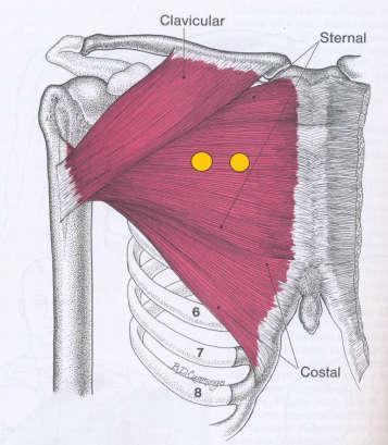 M. pectoralis major (PMa) PMa je mohutný sval, pokrývající přední stranu hrudníku a má podle svých začátků tři části (obr.